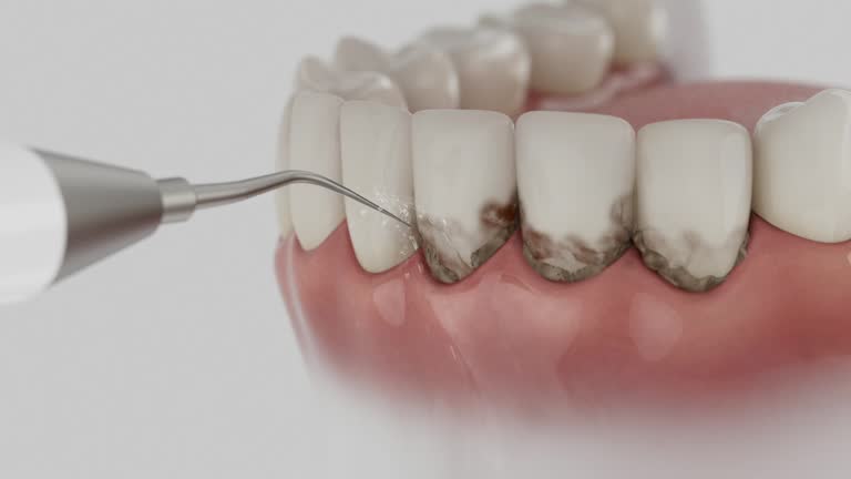 Reliable Dental Implants contractor in Brackettville, TX by Smile Center Dentistry